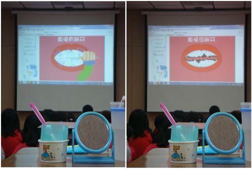 1010320口腔保健宣導