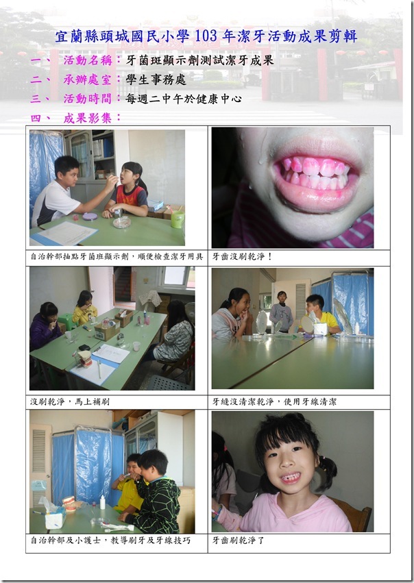 Microsoft Word - 103牙菌斑顯示劑測試潔牙成果剪輯.doc