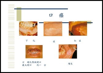 Microsoft PowerPoint - 菸‧檳榔危害防制宣導1050914 [相容模式]00021